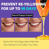 Premium Product Factory Supply Privet Label Teeth Whitening Gel Strips 7 Pouches for Teeth Whitening